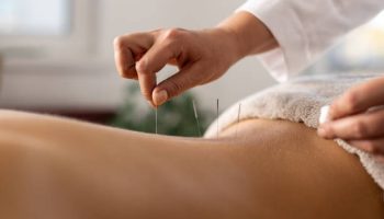 Le Dry Needling chez « 8 Mars.. depuis 1982 » : l’expertise d’Alicia RIMBEAUT